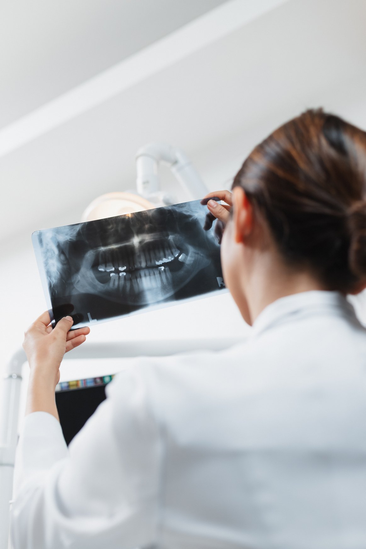 Female Dentist Examining Dental X-ray